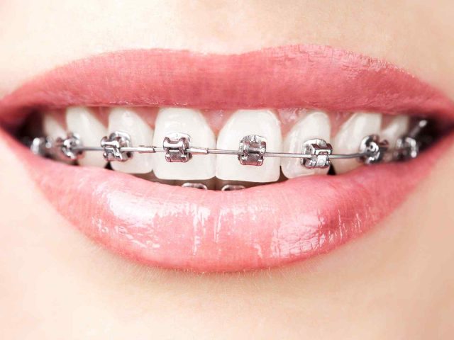 https://clinica-dentaria-faro.pt/wp-content/uploads/2020/01/post_05-640x480.jpg